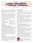 LASER TREATMENT OF FUNGAL TOENAILS
