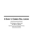 a guide to common oral lesions