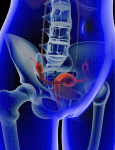 358: Total Abdominal Hysterectomy with Bilateral Salphngo