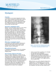 Myelogram - Mayfield Clinic