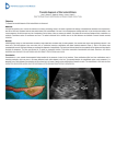 Prenatal diagnosis of fetal enterolithiasis.