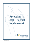 My Guide to Total Hip Joint Replacement