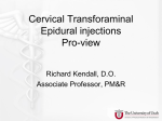 Cervical Transforaminal Epidural injections Pro-view
