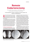 Remote Endarterectomy