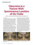Glaucoma in a Patient With Spontaneous Luxation of the Globe