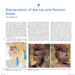 Rejuvenation of the Lip and Perioral Areas