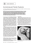 Quinolones and Tendon Ruptures