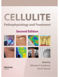 Pathophysiology and Treatment Second Edition