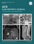 Full Issue PDF - ACG Case Reports Journal