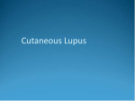 Cutaneous Lupus Erythematosus