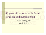 45 year old woman with facial swelling and hypokalemia
