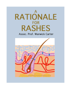 MW_S_Rationales_files/Rash Rationale