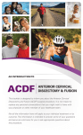 ACDF Patient Brochure