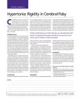 Hypertonia: Rigidity in Cerebral Palsy - occupational