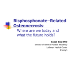 Bisphosphonate – Related Osteonecrois