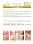 Vbeam Pulsed Dye Laser - Associates in Dermatology