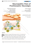 Neuropathic Pain of Postherpetic Neuralgia All rights r