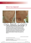 CUTIS Do Not Copy What Is Your Diagnosis? P