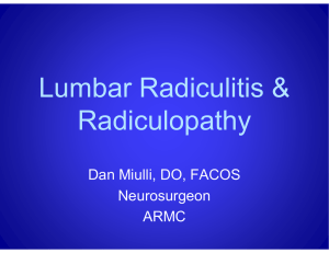 Lumbar Radiculitis &amp; Radiculopathy Dan Miulli, DO, FACOS Neurosurgeon