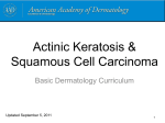 Actinic Keratosis &amp; Squamous Cell Carcinoma Basic Dermatology Curriculum Updated September 5, 2011