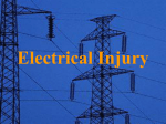 Electrical Injury