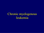 Chronic myeloid leukemia - Katedra i Klinika Hematologii
