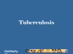 Tuberculosis