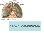 bronchopneumonia