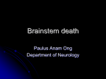 Brain death