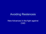 Avoiding Restenosis