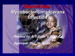 Buruli Ulcer Mycobacterium ulcerans Infection Prepared by