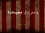 Harlequin Ichthyosis