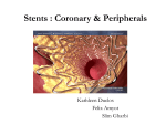 Stents : Coronary & Peripherals