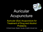 AuricularEarAcupuncture