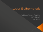 Lupus Erythematosis - University of California, Irvine