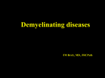 Demyelination