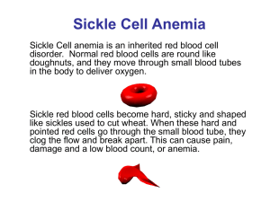 Sickle Cell Anemia