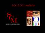 SICKLE CELL ANEMIA