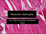 Muscular Dystrophy