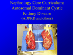 Cystic_Kidney_Disease