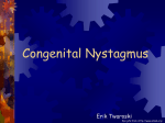 Congenital Nystagmus