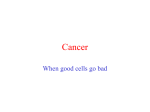 Cancer