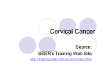Drugs Commonly Used for Treating Cervical Cancer