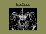 Lung Cancer - UCCS Department of Biology