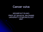 Cancer vulva