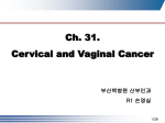 primary vaginal cancer