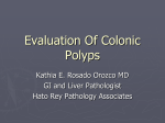 Evaluation of Colonic Polyps 1