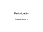 Periodontitis - MDTimisoara.weebly.com
