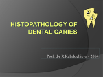 Histopathology of Dental Caries - mu