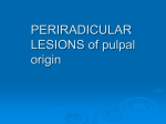 PERIRADICULAR LESIONS